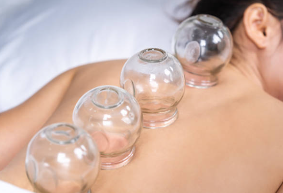 Le Hijama : Une Pratique Ancienne pour un Bien-Être Moderne